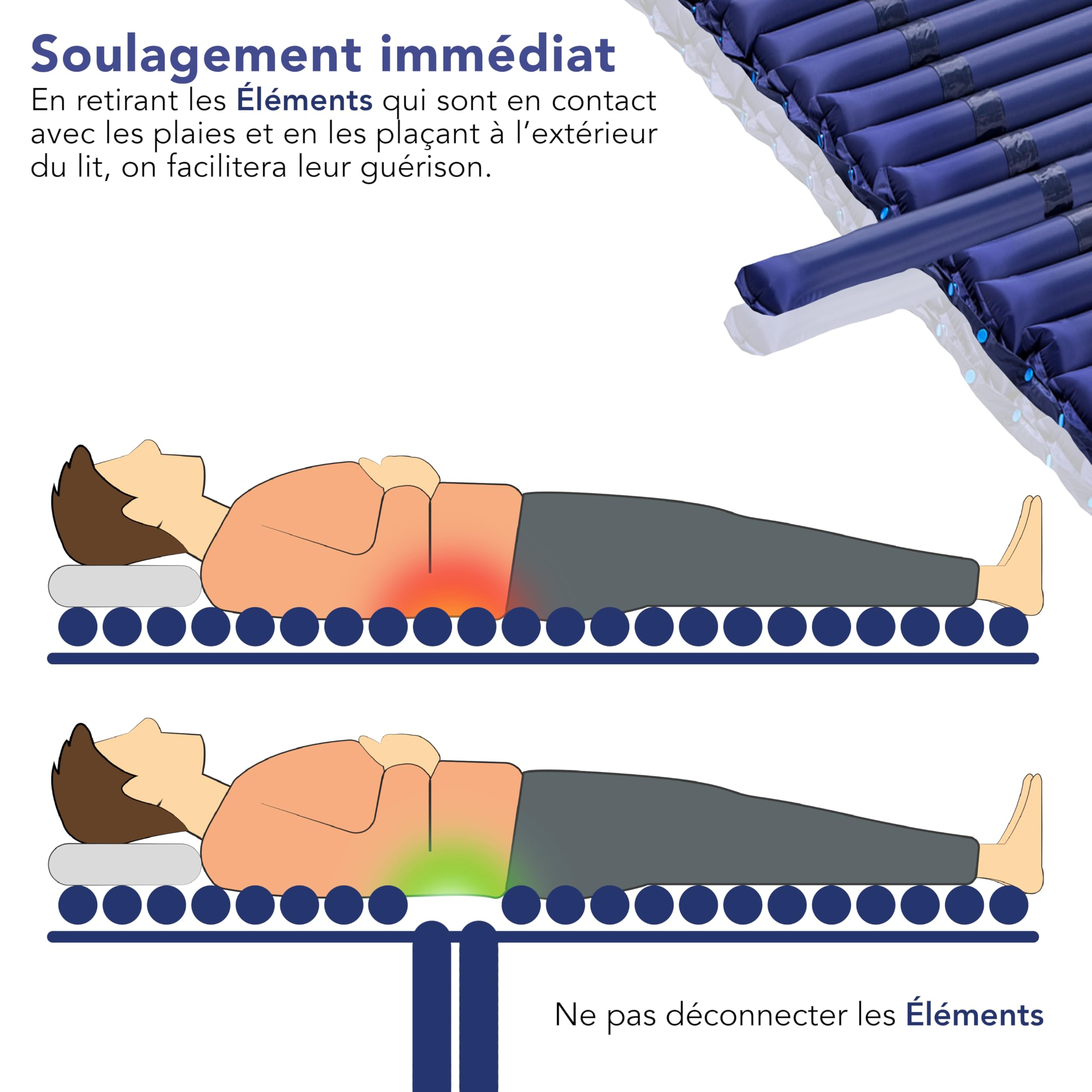 AIESI® Matelas Anti escarres à éléments interchangeables avec compresseur à cycle alterné réglable DOCTOR MATTPLUS, 22 éléments, Capacité 150 Kg, Silent, Garantie 24 mois