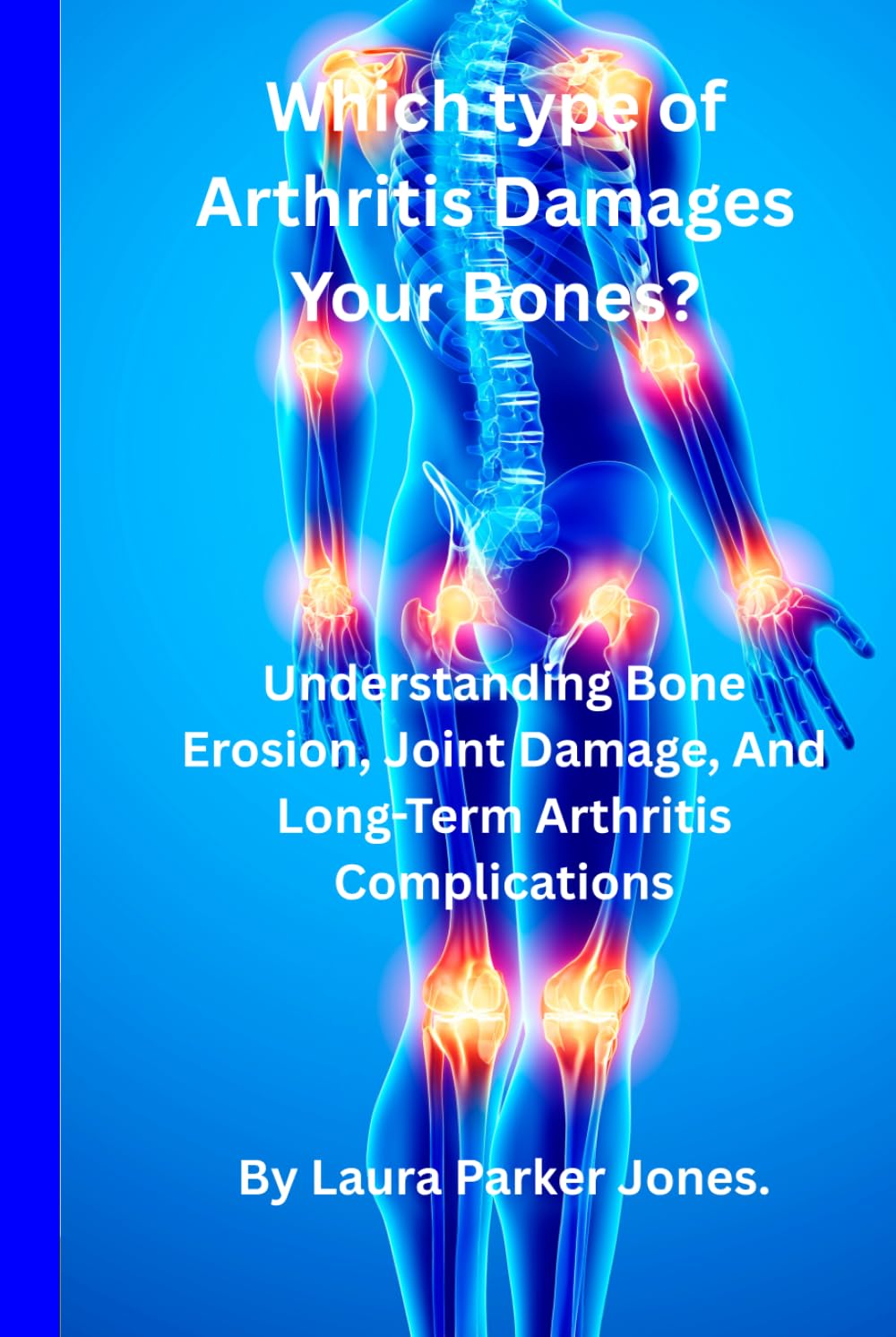 Which Type of Arthritis Damages Your Bones?: Understanding Bone Erosion, Joint Damage & Long-Term Arthritis Complications. (Arthritis and You)
