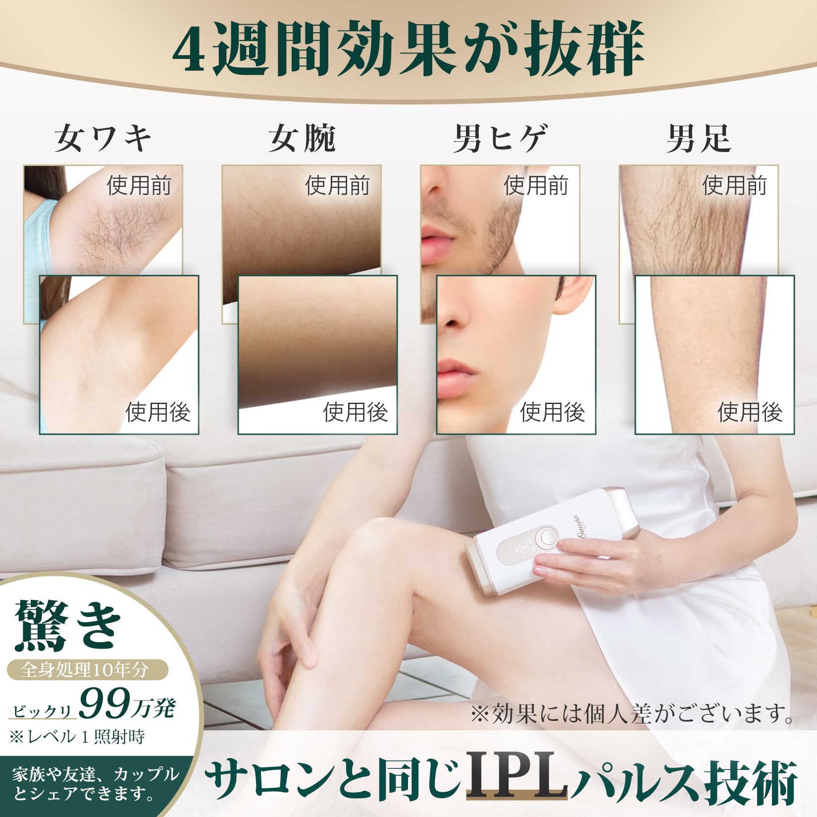 Amazon | Omuse IPL光脱毛器 国内サロン級 光美容器 だつもうき