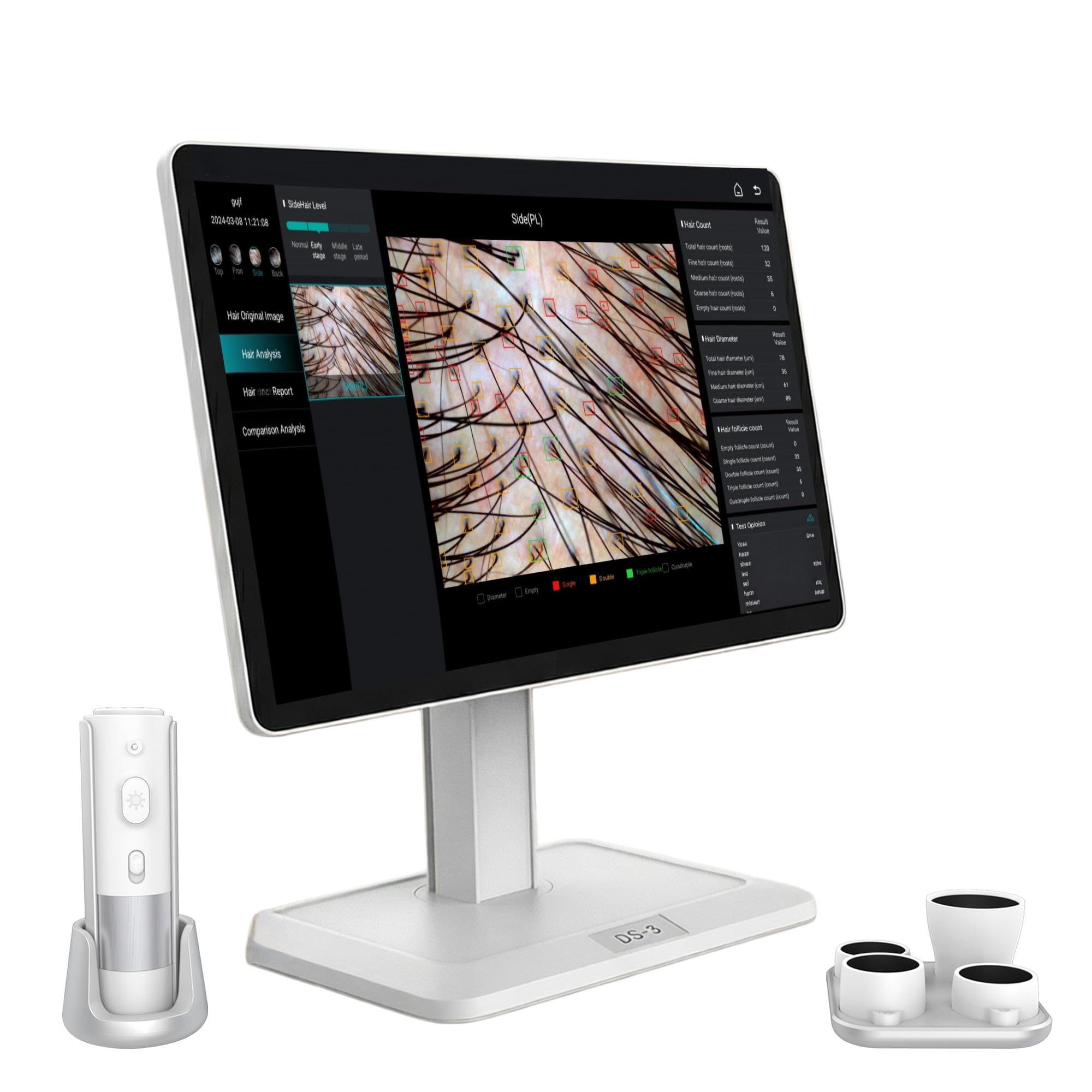 DS3-AI Kopfhautanalysegerät – mit 39,6 cm (15,6 Zoll) Touchscreen, 16 MP HD-Kamera und 4 Objektive (10 x 200 x), dreispektraler Haarfollikel-Scanner für Kopfhaut-Wellness und Salonpflege, mit