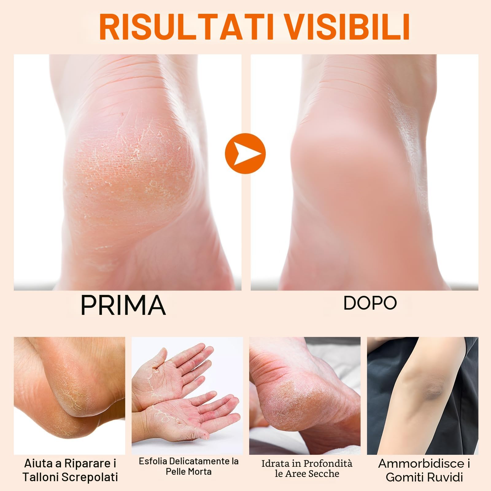 Stick Crema per Talloni e Gomiti al Miele di Manuka, Trattamento Idratante ed Esfoliante per Talloni Secchi e Screpolati e Pelle Ruvida, Ammorbidente per Calli, Levigante per la Pelle, 40g