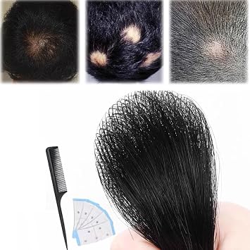 Bald Spot Hair Patch Wig, Natural Look Hair Replacement Unit For Bald Spot Thin Skin Hairpiece 1.5*1.5cm