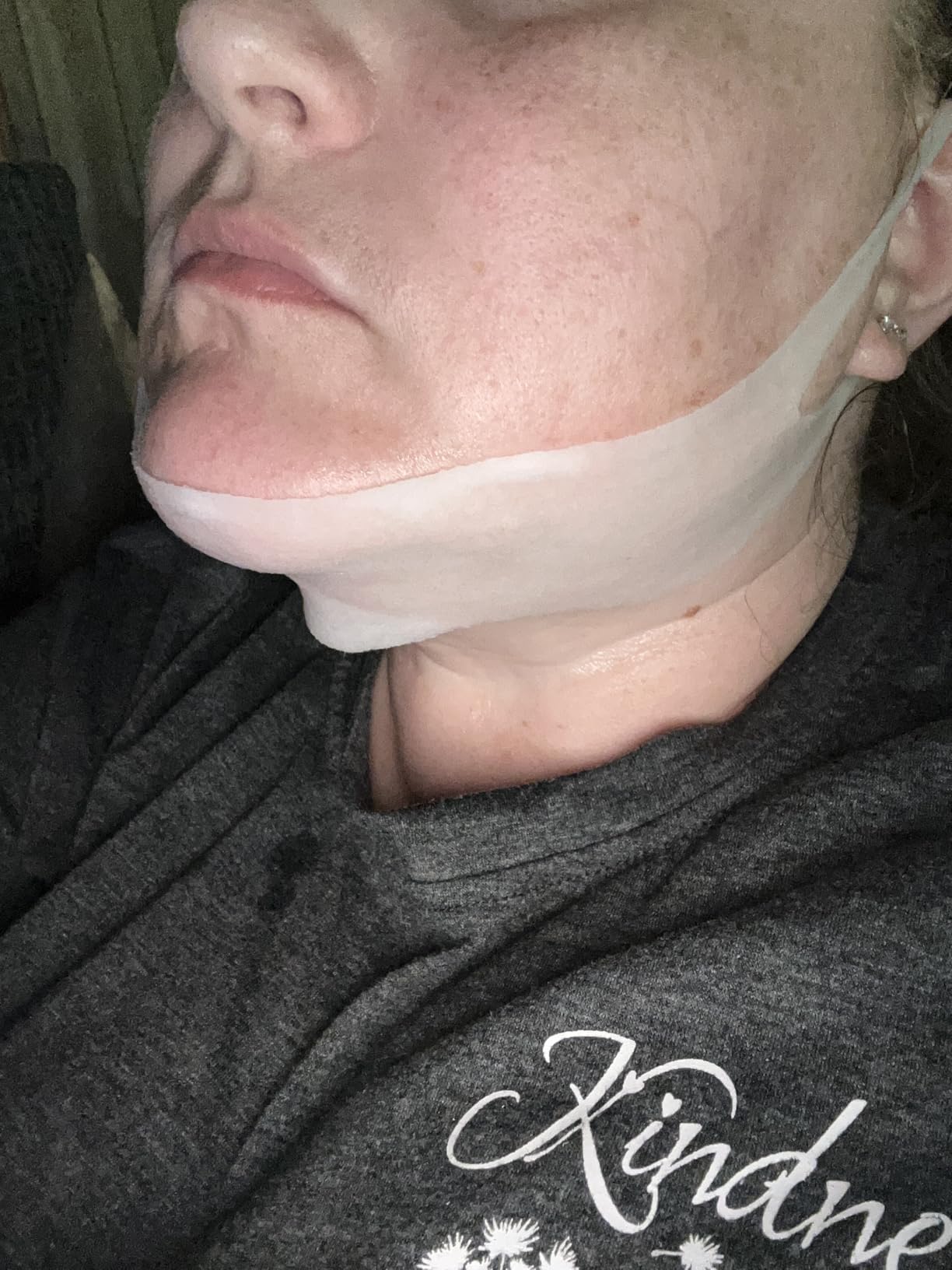 YAFUSIPE V Line Face Lifting Mask, 10 Pack V Line Chin Strap Lifting Double Chin Reducer, Polypeptide Protein Collagen Neck and Face Slimming Masks, Hydrating Neck Sheet Mask for Women Tightening