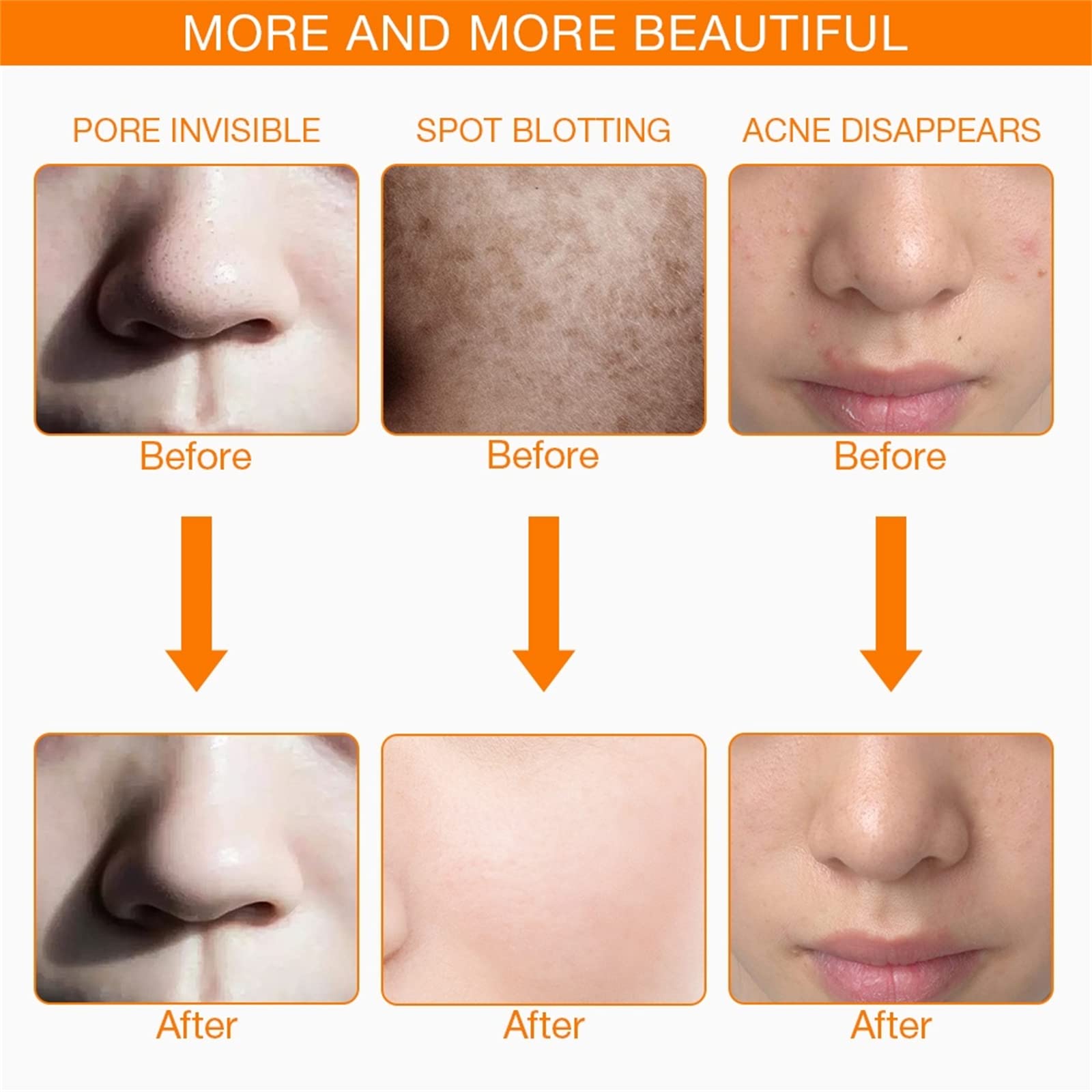 7 Colores Terapia de luz LED Mascarilla Cuello Rejuvenecimiento de la Piel Fototerapia Máscara de Belleza Anti Acné Apriete la Piel Aclare la máquina Salón de Belleza Cuidado de la Piel,Oro