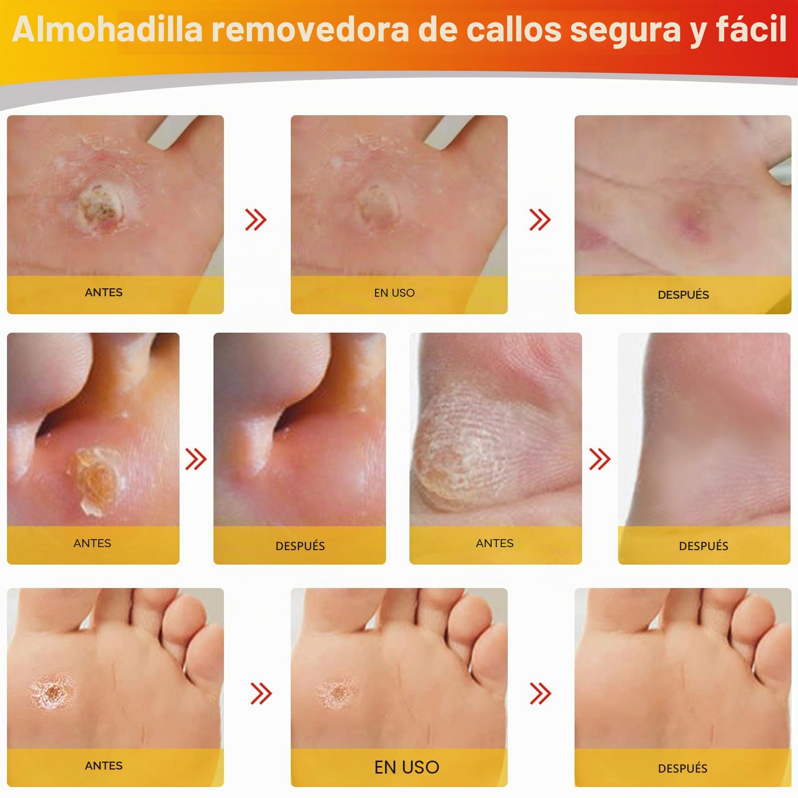 MYMULIKE 24 almohadillas para eliminar los callos, 2 tamaños de almohadillas para eliminar los callos en los pies, 12 tamaños grandes y 12 tamaños pequeños para el cuidado de los pies.