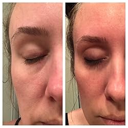 Customer Image, click to open customer review