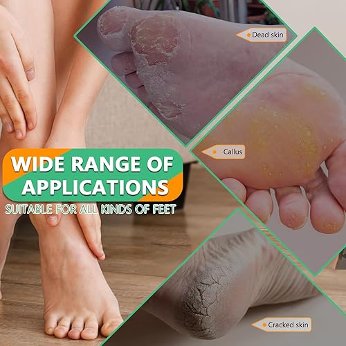 Miniatura 4 de Lima de pedicura profesional y removedor de callos  Material de acero inoxidable, mango ergonómico, puede quitar fácilmente la piel dura, callo,