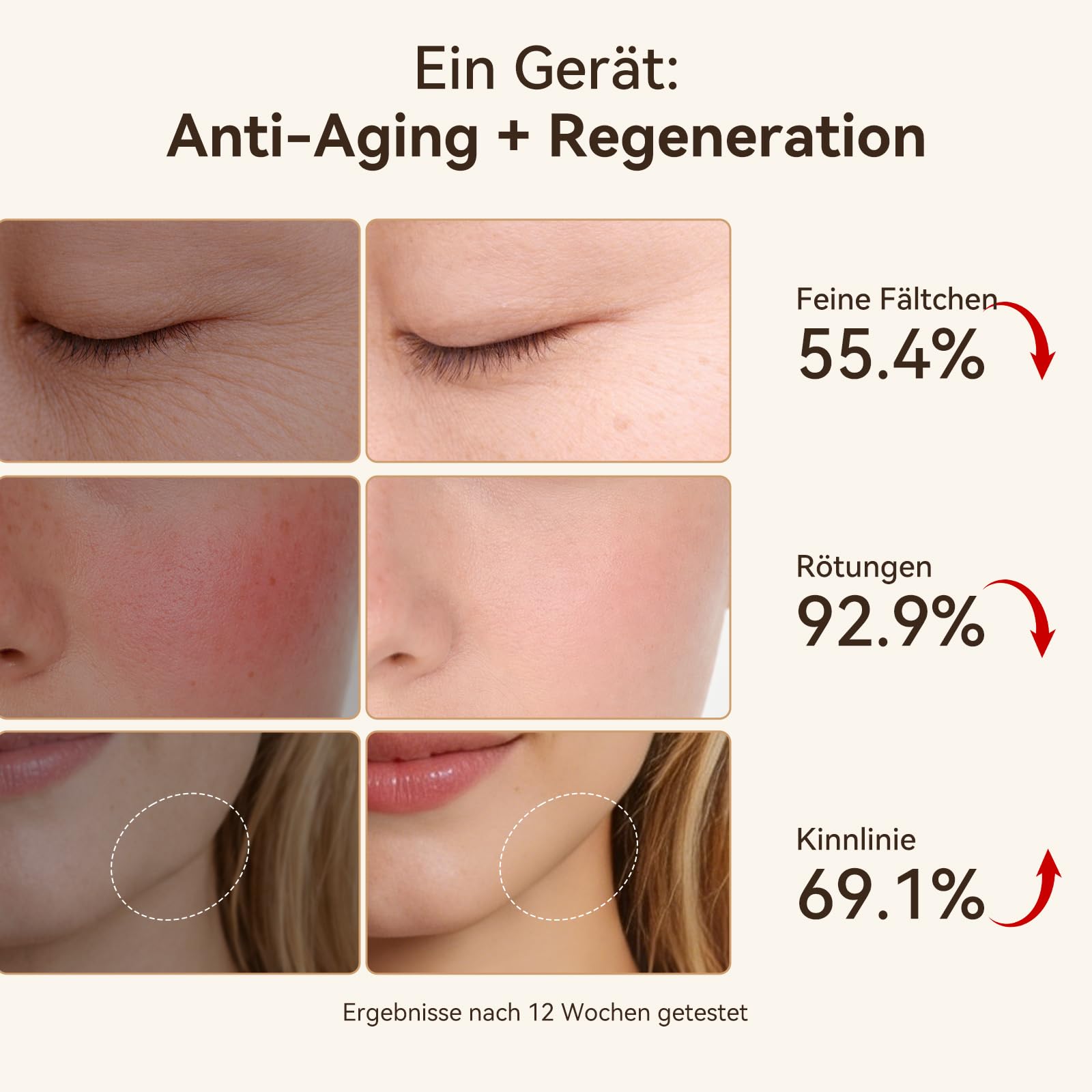 ANLAN EMS Gesichtsmassagegerät, Radiofrequenz mit 3 Vibrationsstufen & Phototherapie Gerät Gesicht Massagegerät, Anti-Falten Gesichtsmassagegerät für Gescht/Hals, Reduziert Schwellungen & Falten Firm