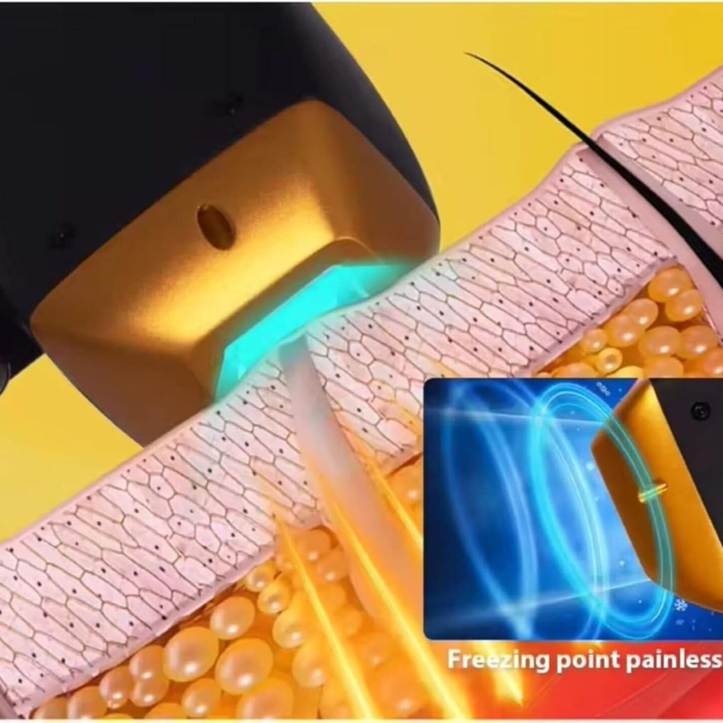 Epilatore 2 in 1 con Raffreddamento a Ghiaccio, Depilazione Senza Dolore per Corpo e Viso, Adatto a Tutti i Tipi di Pelle e Zone Intime, Risultati Duraturi