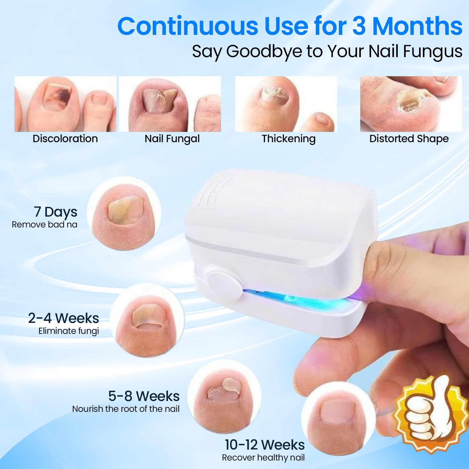 Appareil Laser Pour Traitement Des Mycoses Des Ongles Des Pieds - Portable Et Rechargeable
