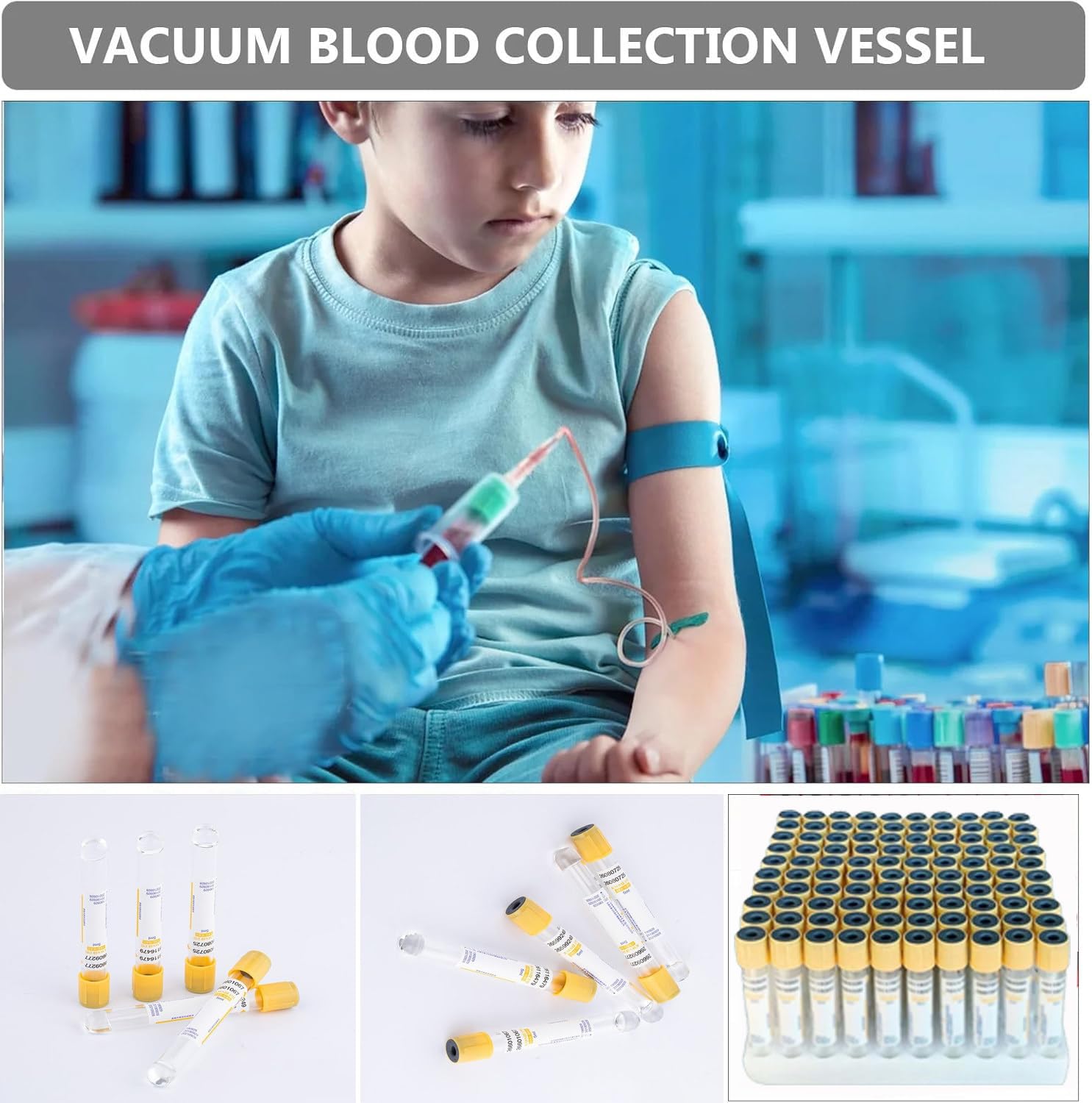 Provette sottovuoto per prelievo di sangue con gel di separazione per test sierologici, 100 pezzi