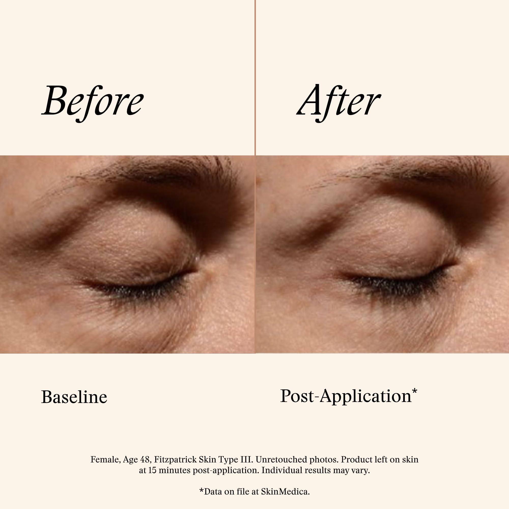 SkinMedica Instant Bright Eye Cream - Our Age-Defying Under the Eye Cream Instantly Improves Eyes’ Appearance, Including Dark Circles, Sagging, Puffiness and Lines