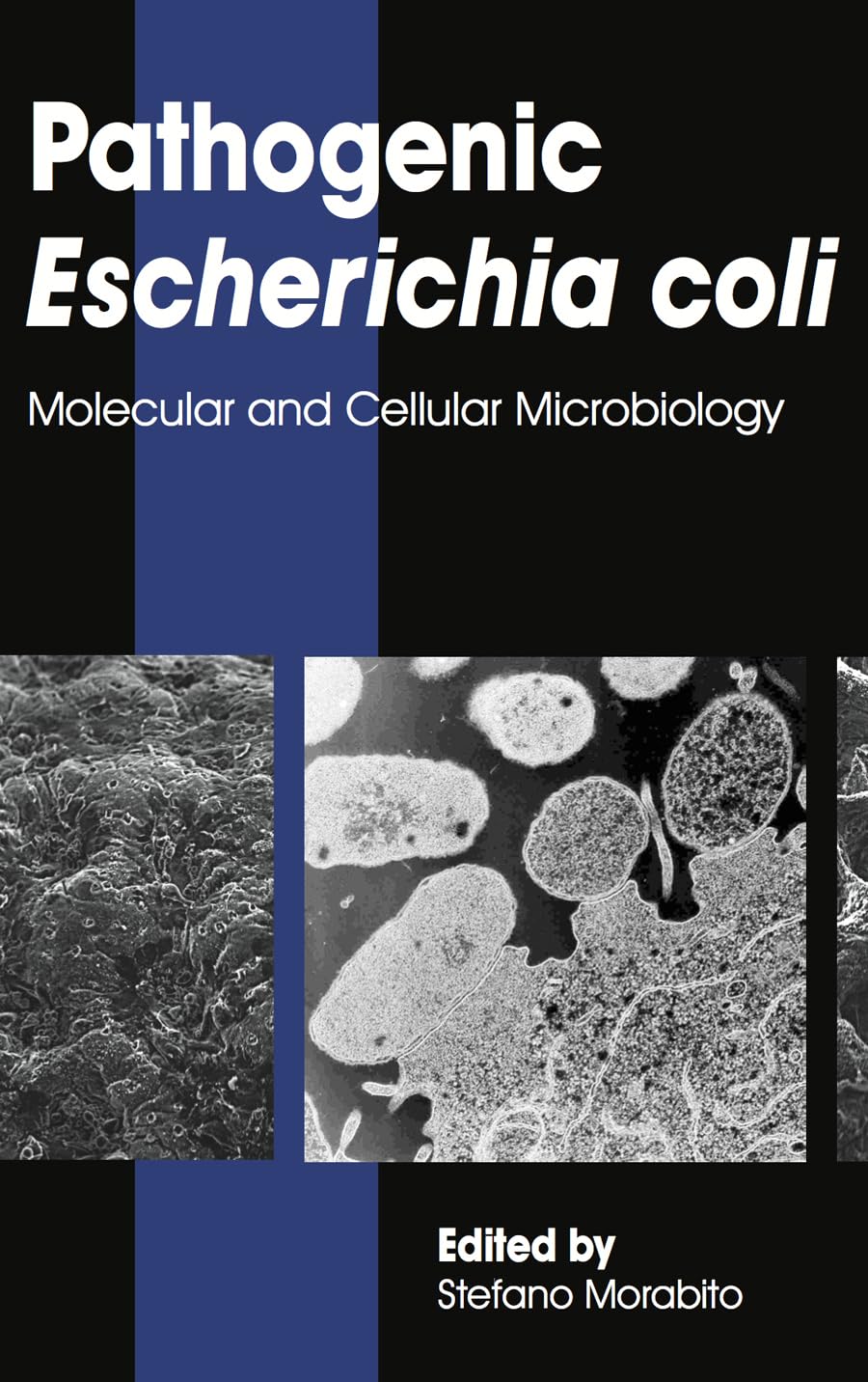 Buy Pathogenic Escherichia Coli: Molecular and Cellular Microbiology — BookShops.in