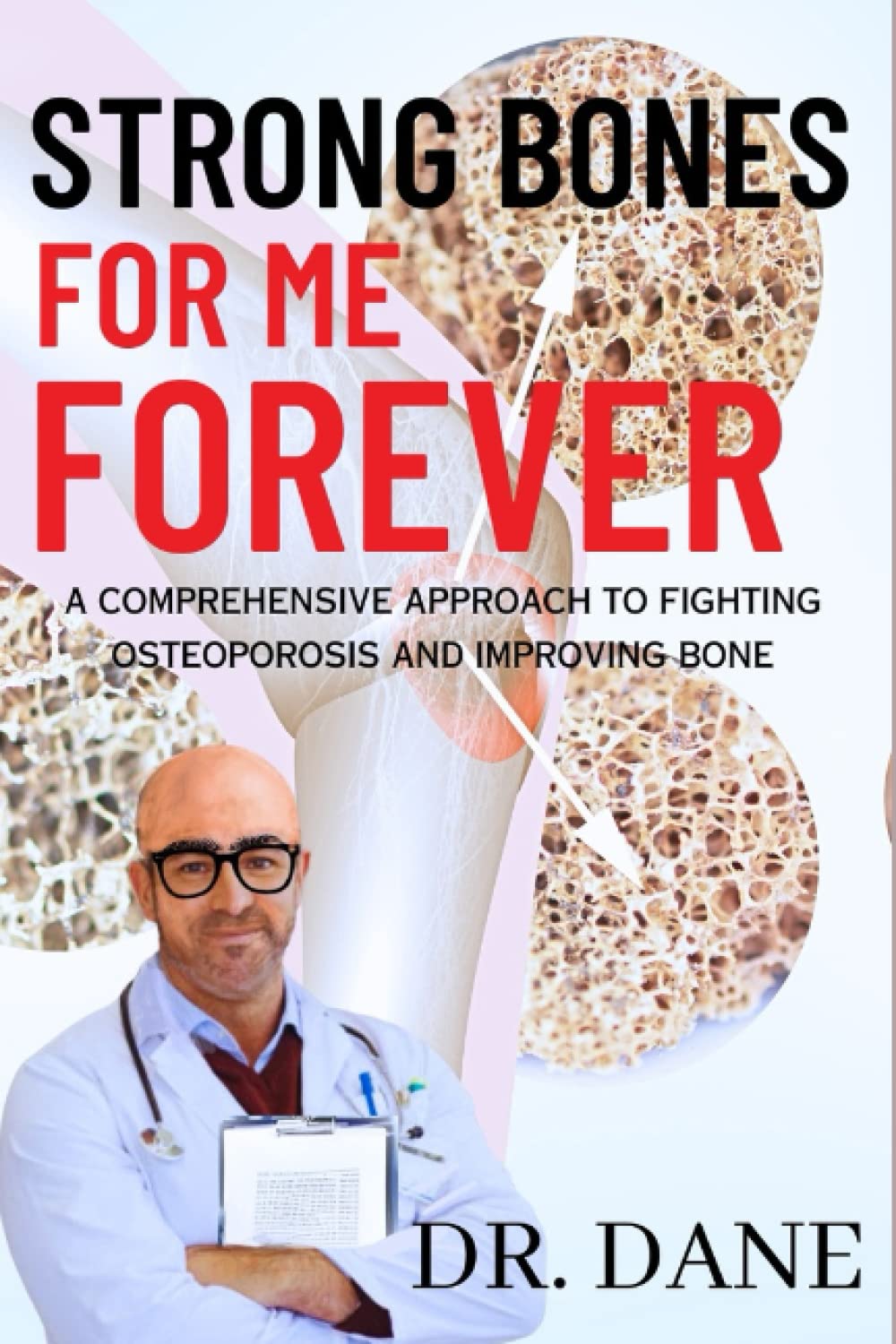 Strong Bones For Me Forever: A Comprehensive Approach to Fighting Osteoporosis and Improving Bone