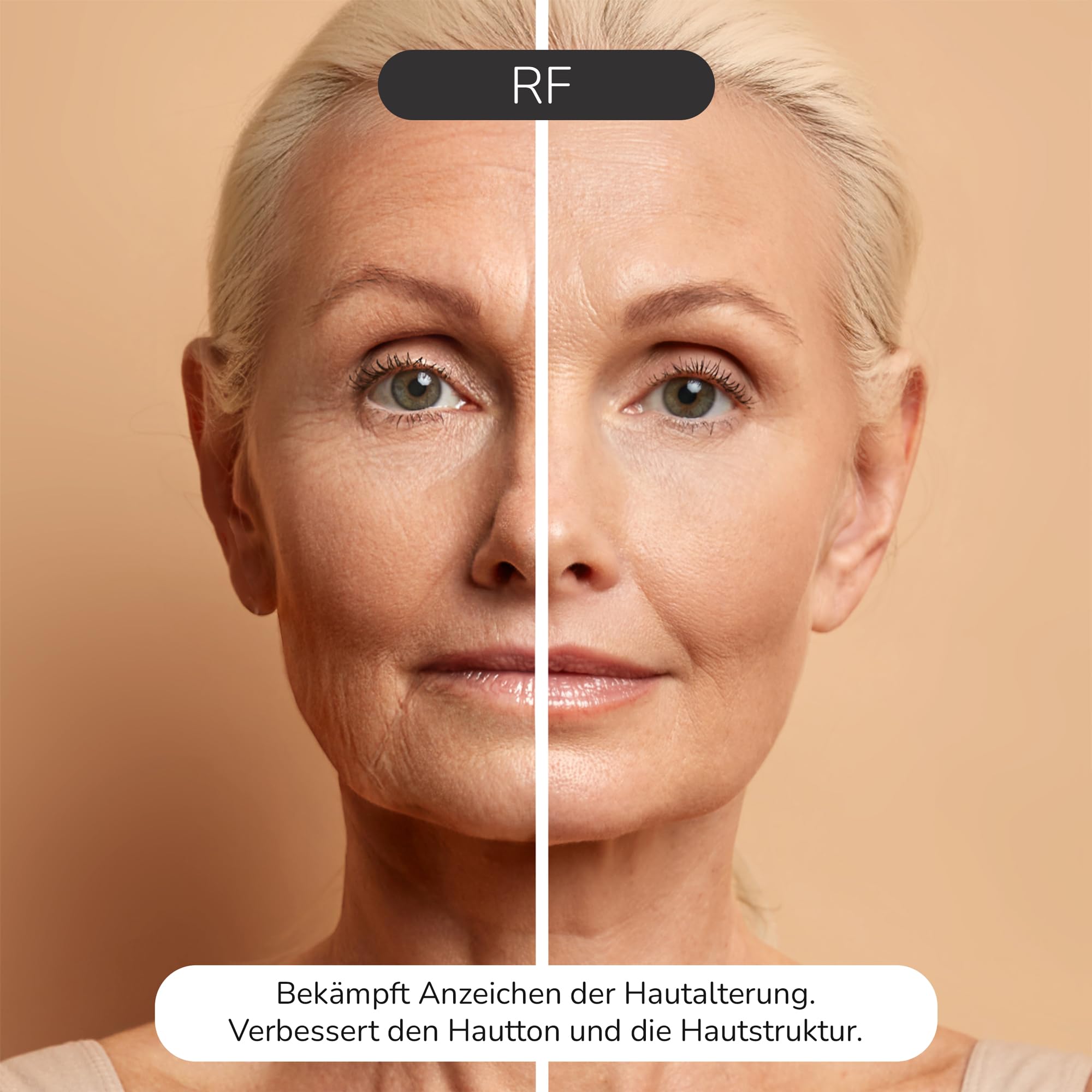 Radiofrequenz-Gerät für das Gesicht: Hautstraffung mit 20 RF-Modulen und Mikrostrom EMS Technologie, Stempel- und Gleitmodus, NTC-Temperatursensor, 3,5mm Eindringtiefe für Anti-Aging