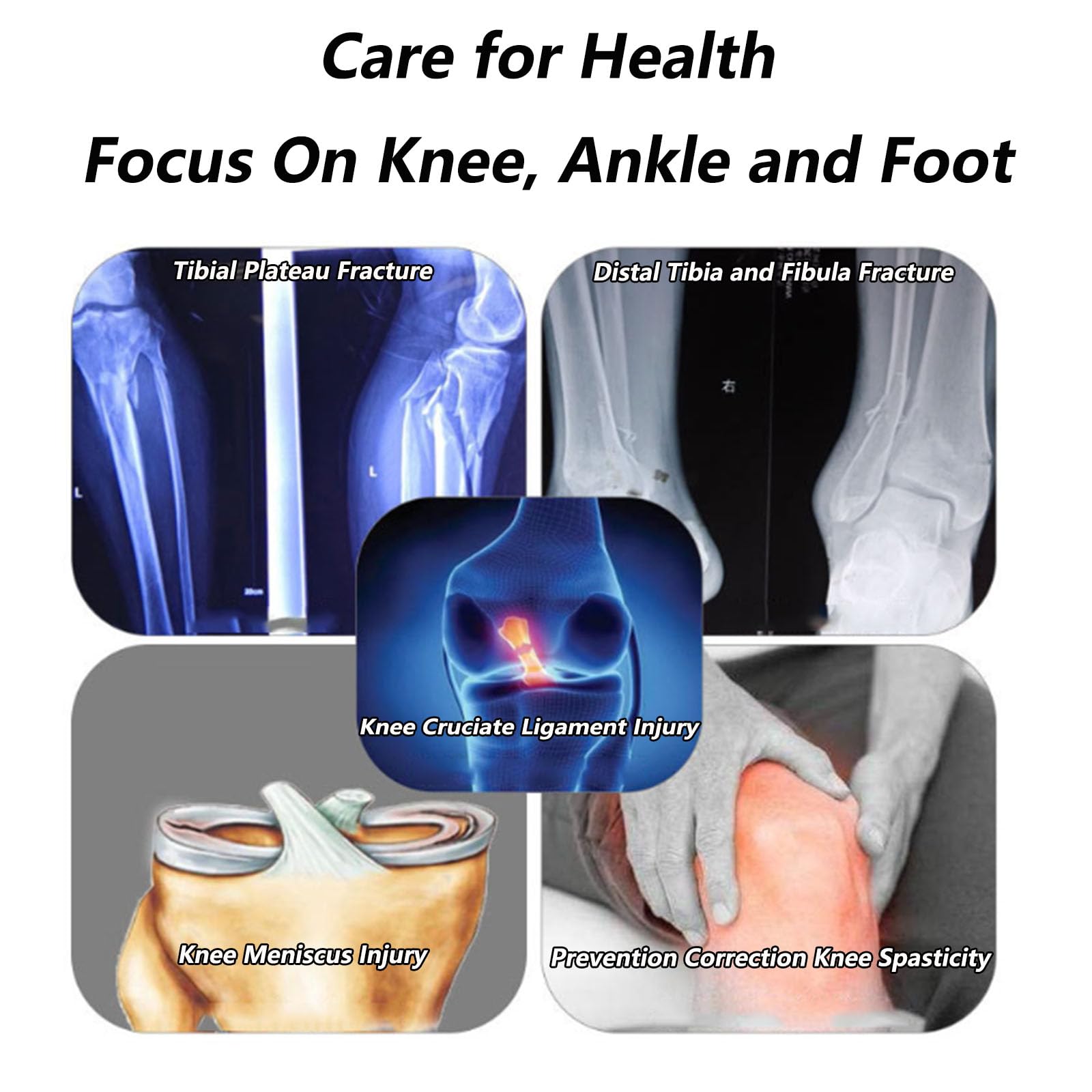 Soporte de ortesis de Rodilla Estabilizador de articulación Ajuste Ajustable Hip Costa Hip Abducción de ortesis Ayco de la Pierna Soporte de articulación para ACL, PCL, MCL, Artritis, A Derecha, B