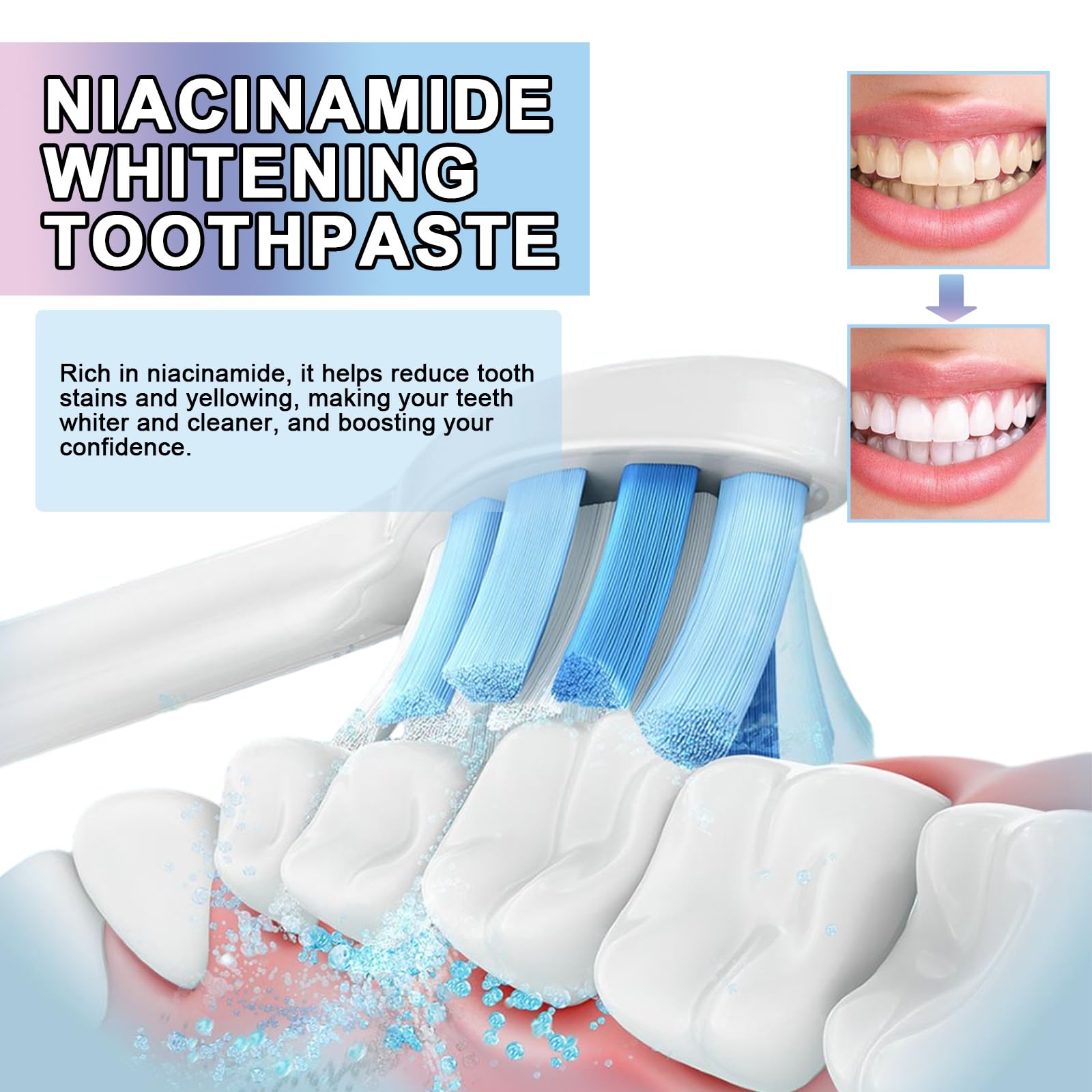 Niacinamide Whitening Toothpaste, Helps Remove Teeth Stains, Brightening, Fresh Mint Flavor for Long-Lasting Breath, Gently Cleans and Protects Gums, Safe for Tooth Surface Whitening Care (5PCS)