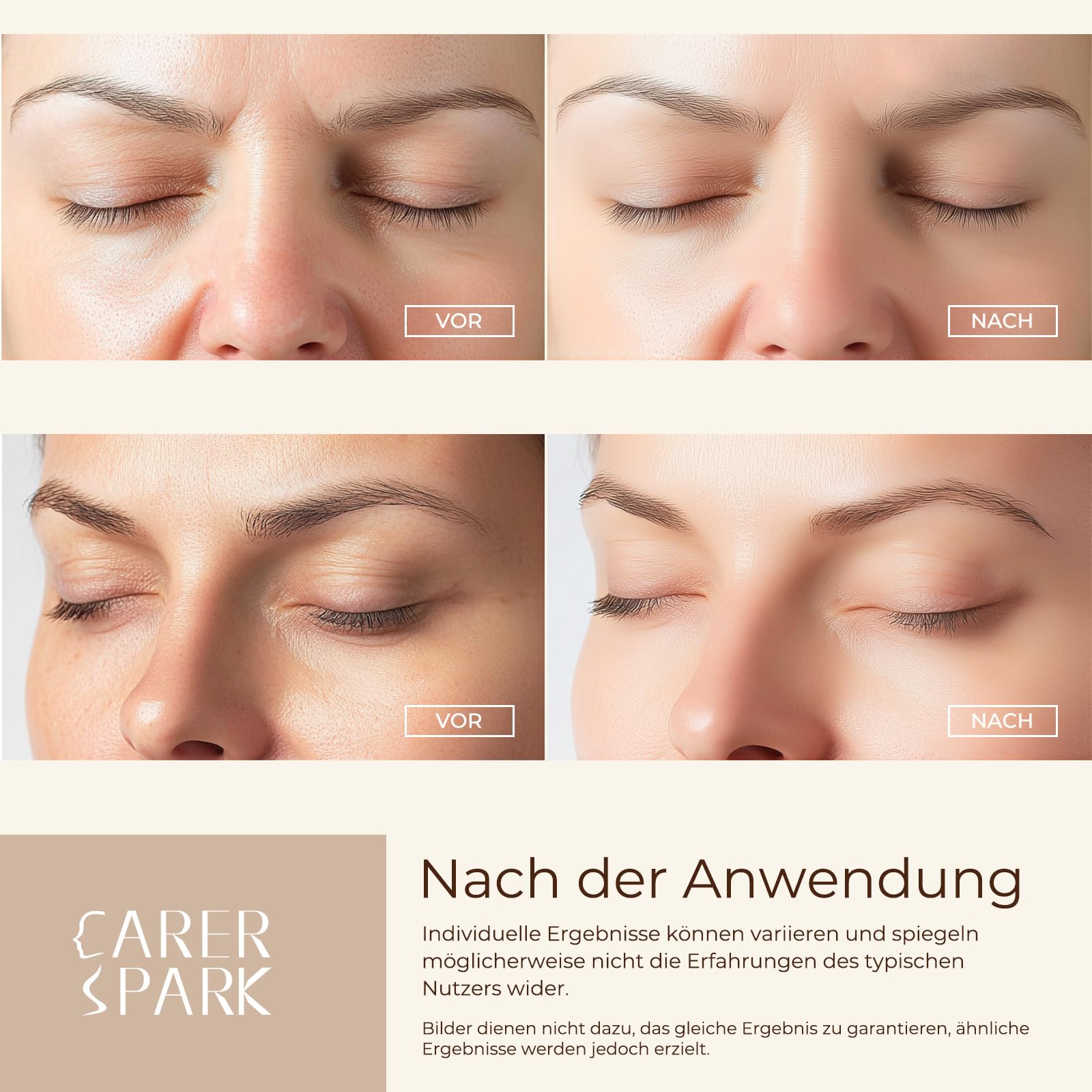 CARER SPARK Ultraschallpeelinggerät, Skin Scrubber Ultraschall EMS Ionisches Lichttherapie mit 4 Modi für Tiefenreinigung Mitesserentfernung und Sanftes Peeling USB Wiederaufladbares