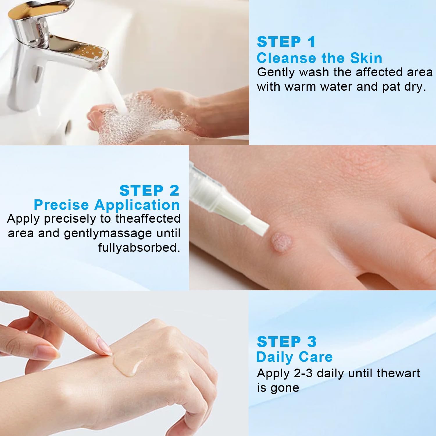 Fast Acting Salicylic Acid Wart Remover Pen with Brush - Wart Removal for Plantar Warts, Common & Corn on Feet & Hands I Gentle Formula,Travel Size (0.085FL.OZ/2.5ml)