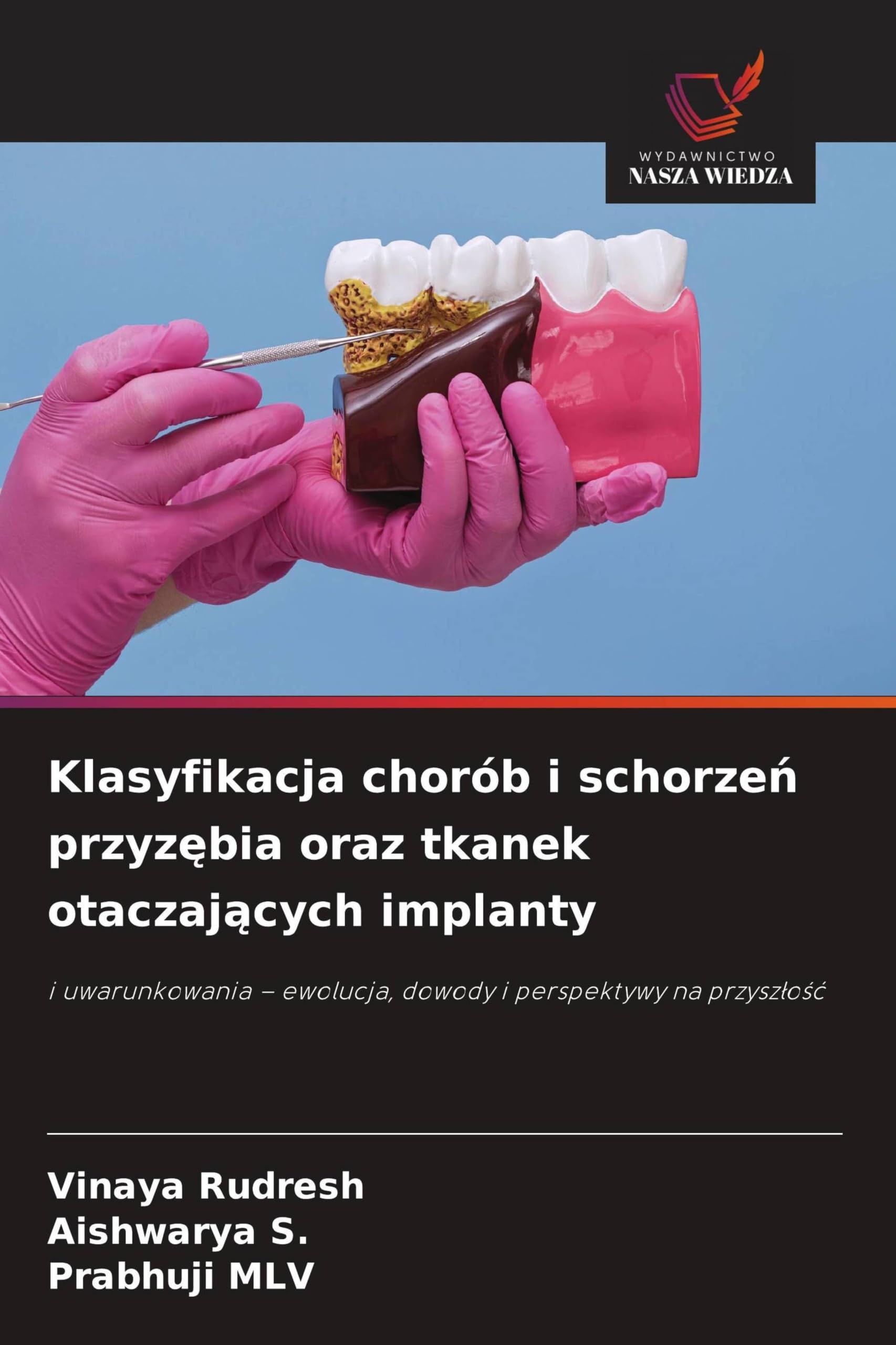 Klasyfikacja chorób i schorze¿ przyz¿bia oraz tkanek otaczaj¿cych implanty: i uwarunkowania - ewolucja, dowody i perspektywy na przysz¿o¿¿