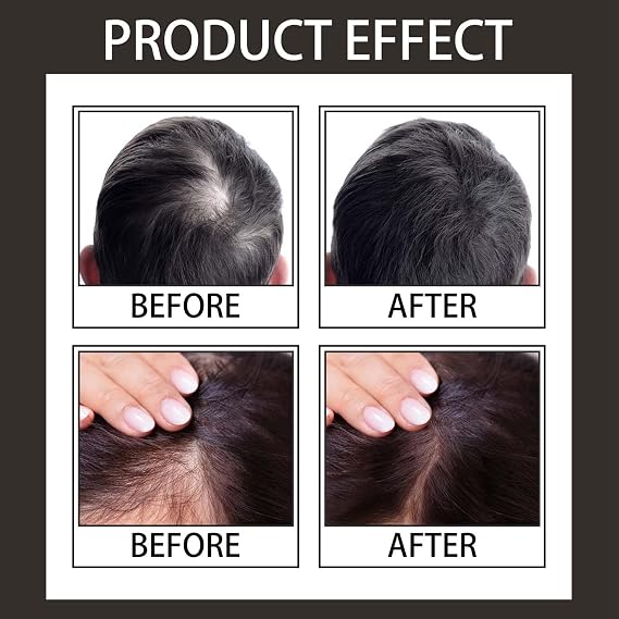 Hairline Powder Hair Shadow Powder for Filling in Thinning Hair Hair Root Dye Touch Up hair powder Hair Root Concealer For Makeup for Men and Women, Windproof & Sweatproof, with Mirror &Puff (Black)