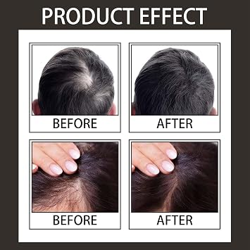 Hairline Powder Hair Shadow Powder for Filling in Thinning Hair Hair Root Dye Touch Up hair powder Hair Root Concealer For Makeup for Men and Women, Windproof & Sweatproof, with Mirror &Puff (Black)