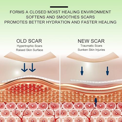 Miniatura 3 de Hojas de silicona para cicatrices, 16 unidades, tiras de cinta para cicatrices, cicatrices de cirugía curativa, queloides, cesárea, reutilizable,