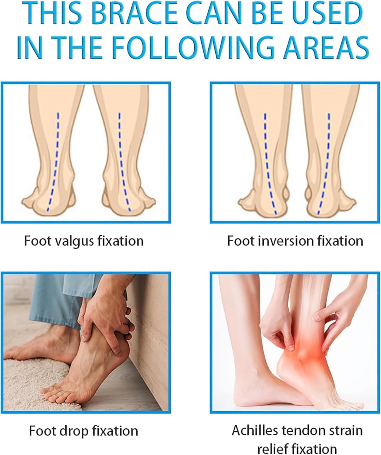 Ortesis para pie caído con forro transpirable para soporte al caminar, ortesis de tobillo AFO para asistencia a la dorsiflexión, alivio de la fascitis plantar, recuperación de accidentes cerebrov