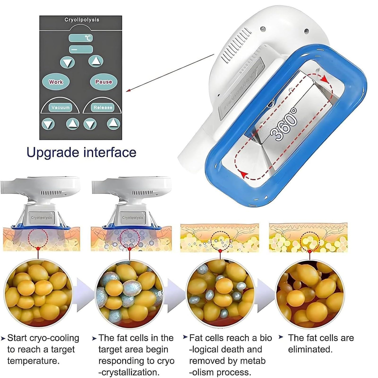 Máquina De Criolipólisis Y Congelación De Grasa con 3 Mangos - Máquina De Adelgazamiento Y Modelado Corporal - Crioterapia para Eliminar Celulitis Y Contorno Corporal