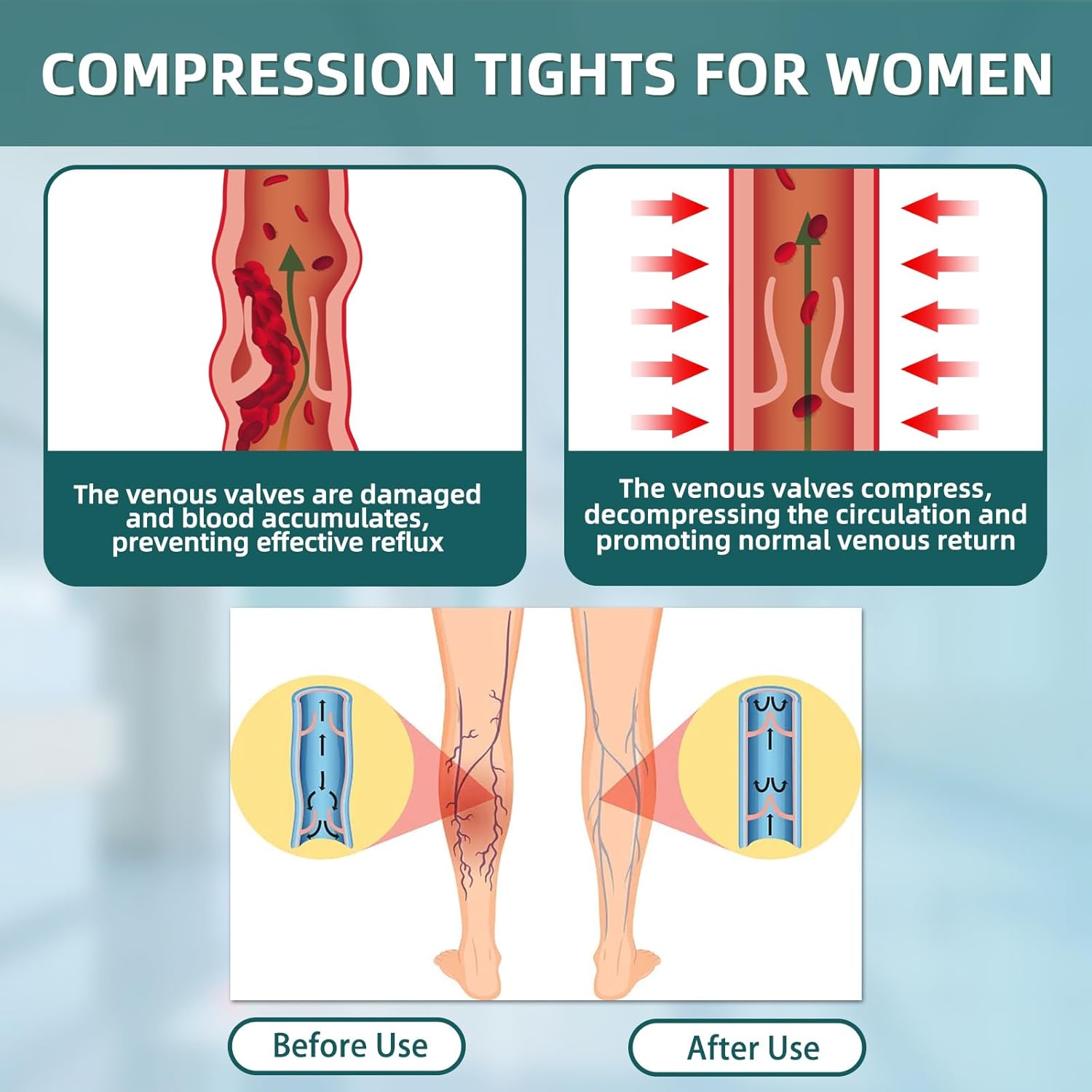 2 Pairs 20-30mmHg Compression Pantyhose for Women, Medical Graduated Compression Stockings Leggings Footless Support Compression Tights for Varicose Veins, Swelling, Edema - Image 5