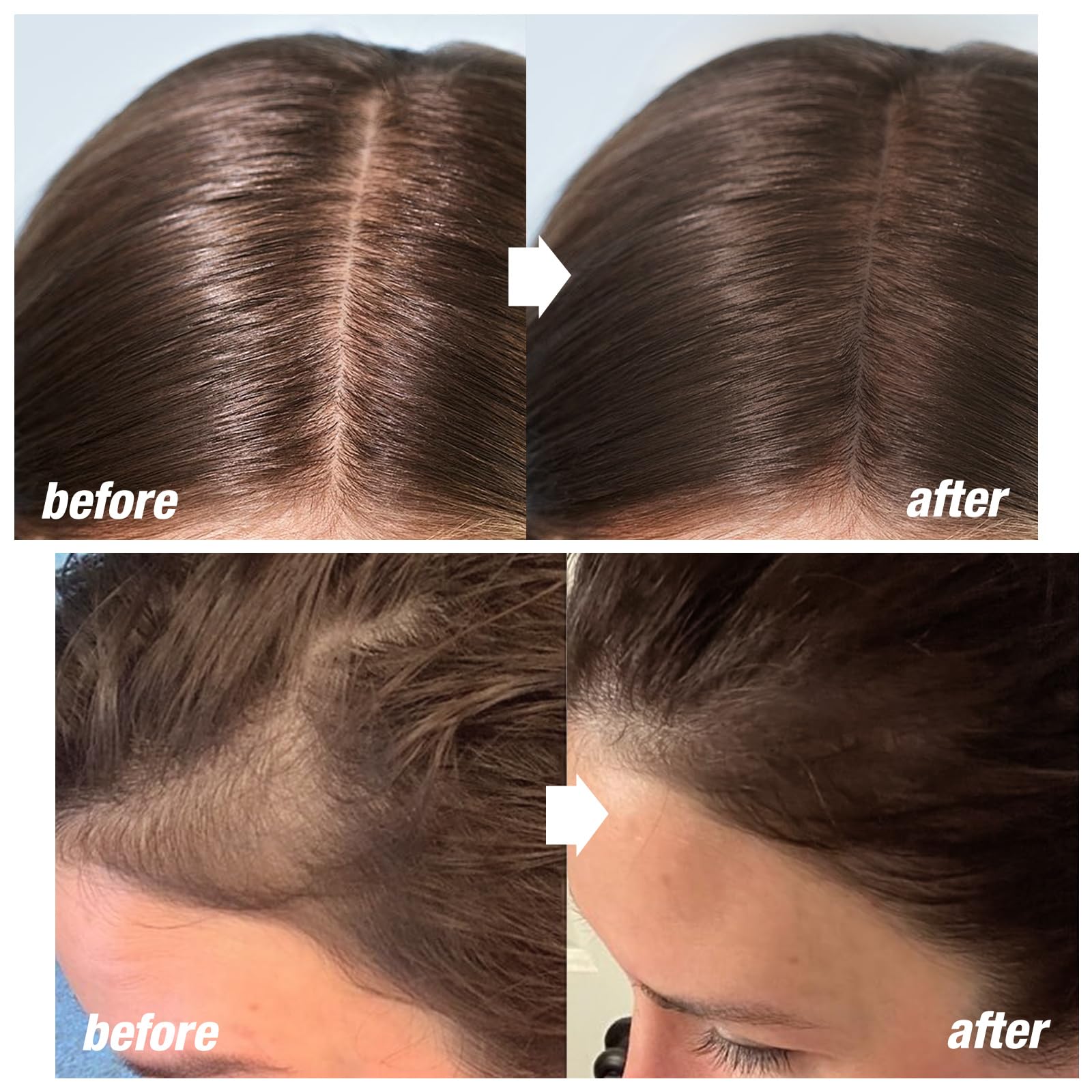 Boobeen Hairline Shadow Stick, Hair Root Concealer & Touch Up Powder With Sponge, Instant Cover Up For Thinning Grey Hair - Image 2