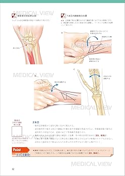 新OS NEXUS No.15 小児の骨折と手術 新OS NEXUS No.15 小児の骨折と手術 メジカルビュー社｜整形外科｜