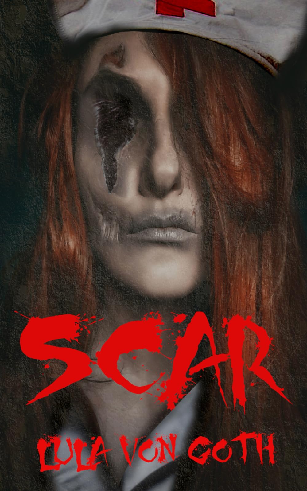 Scar