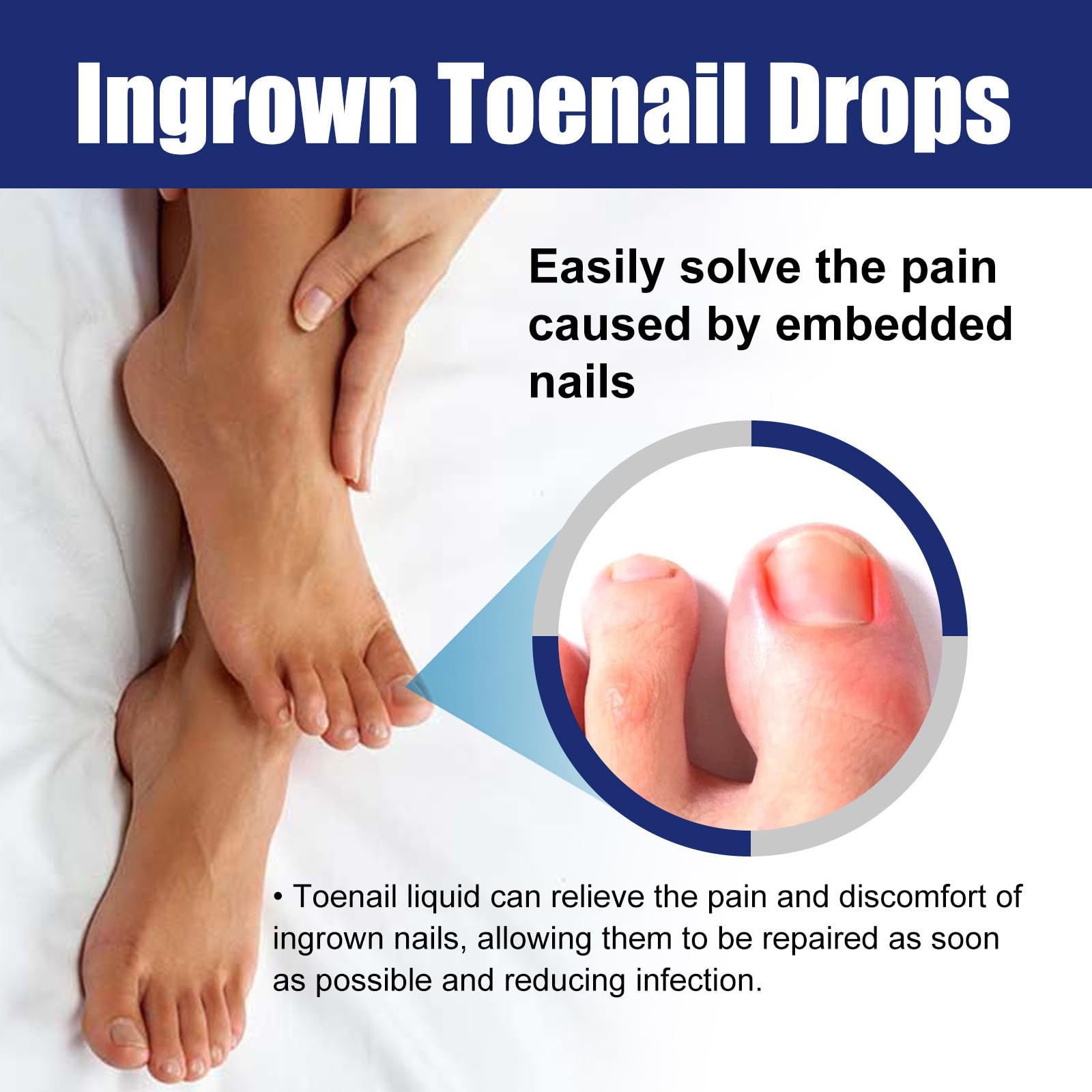Ingrown Toenail Liquid - 30ML Ingrown Toenail Correction Drops - Nail Helper Ingrowth Toenail Oil - Trimming Toenail Softening Drops - Image 3