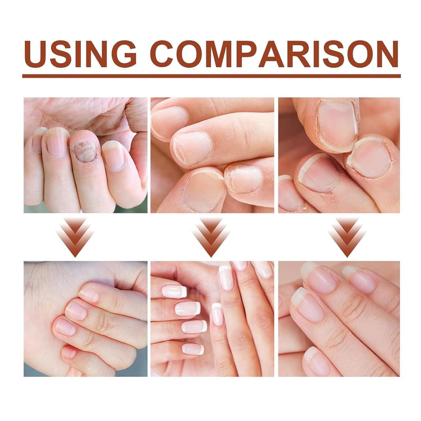 Aceite de cuidado de uñas de 3 días, fortalecimiento de esmalte de uñas, aceite para cutículas, tratamiento de aceite de uñas para uñas dañadas, tratamiento de uñas con queratina para fortalecer la