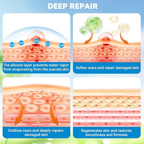 Miniatura 2 de Láminas de silicona para cicatrices faciales cinta para cicatrices quirúrgicas, parches de arrugas de grado médico, tiras reutilizables, tratamiento
