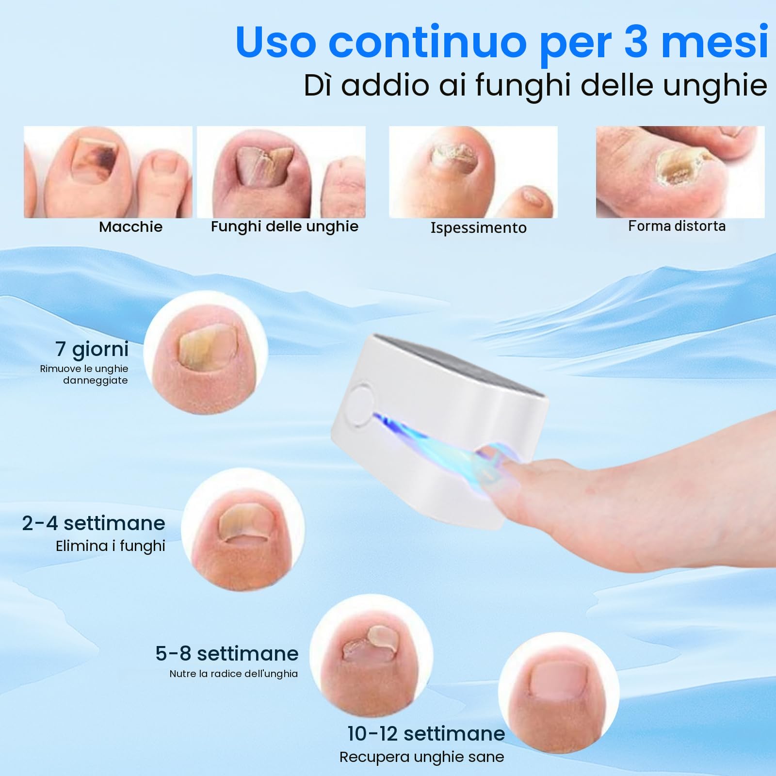 Mycose delle Unghie Laser, Mycose delle Unghie dei Piedi Pulizia e Riparazione Unghie, Dispositivo Trattamento Laser per Micosi delle Unghie dei Piedi, 7 Min al Giorno per Migliorare la Micosi Fungosa