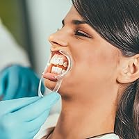 Vista 4 de 10 piezas de retractor de mejilla en forma de C, abridor de boca desechable para blanqueamiento dental, protector bucal o juego Speak Out (Blanco M)