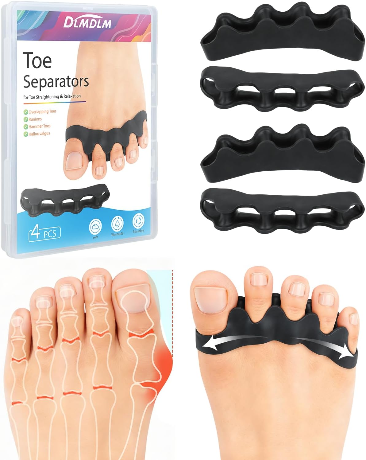 DLMDLM 4PCS Silicone Toe Separators to Correct Toes Alignment for Women and Men, Toe Spacers Straightener for Bunion Relief, Hammertoes and Overlapping Toes (Medium)