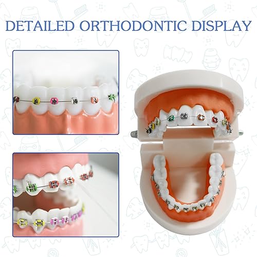 Miniatura 2 de Modelo de dientes de ortodoncia dental con aparatos ortopédicos coloridos, modelo profesional de boca de dentadura para demostración de estudio para