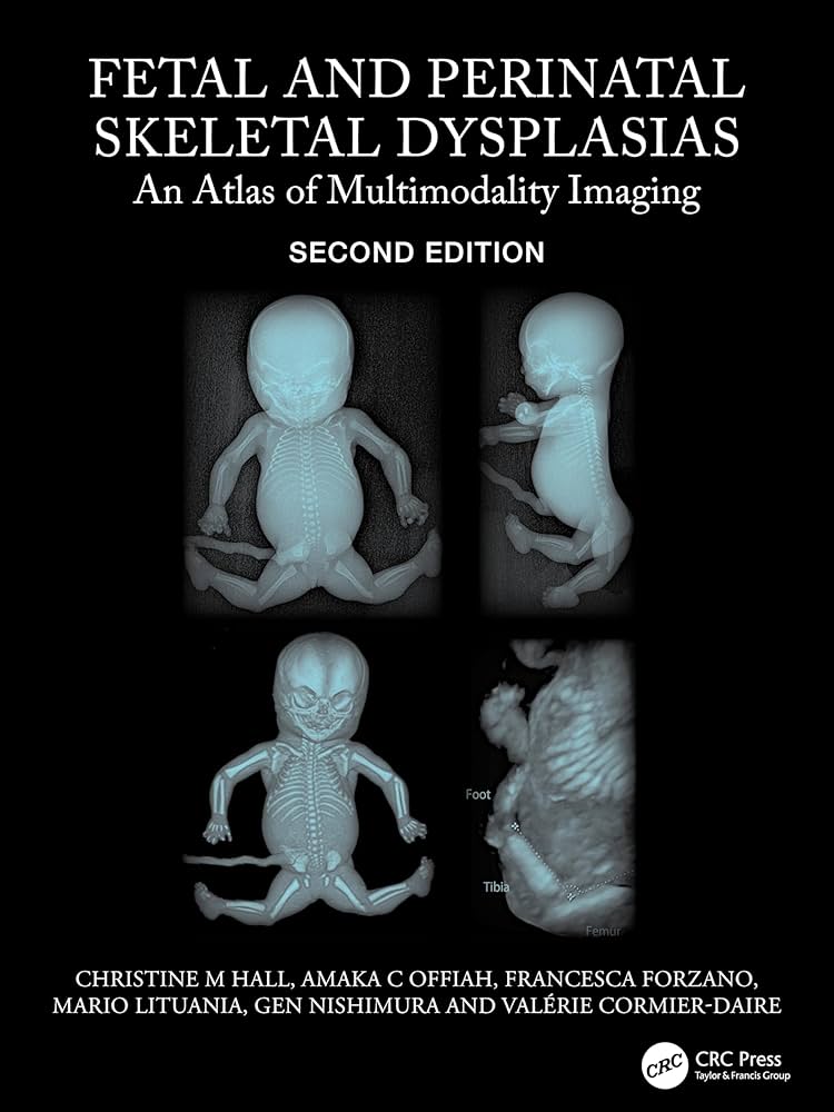 Fetal and Perinatal Skeletal Dysplasias: An Atlas of