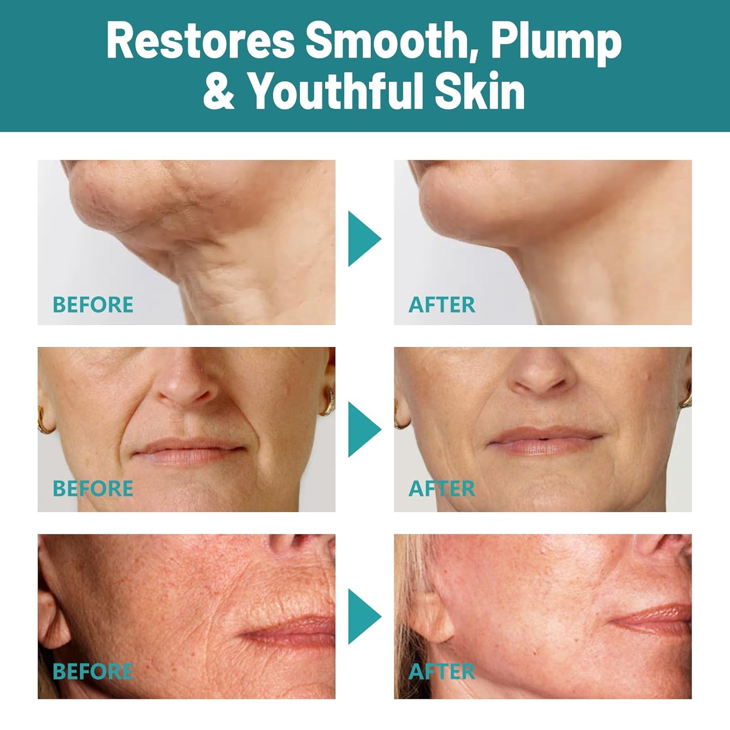 Crepes skin cream for aging skin ，Crepes Skin Repair Treatment, Firming Cream with Hyaluronic Acid & Shea Butter to Deeply Moisturize & Tighten Wrinkly Dry - Image 6