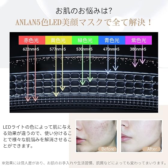 ANLAN ANLAN 5色LED美顔マスクの商品画像