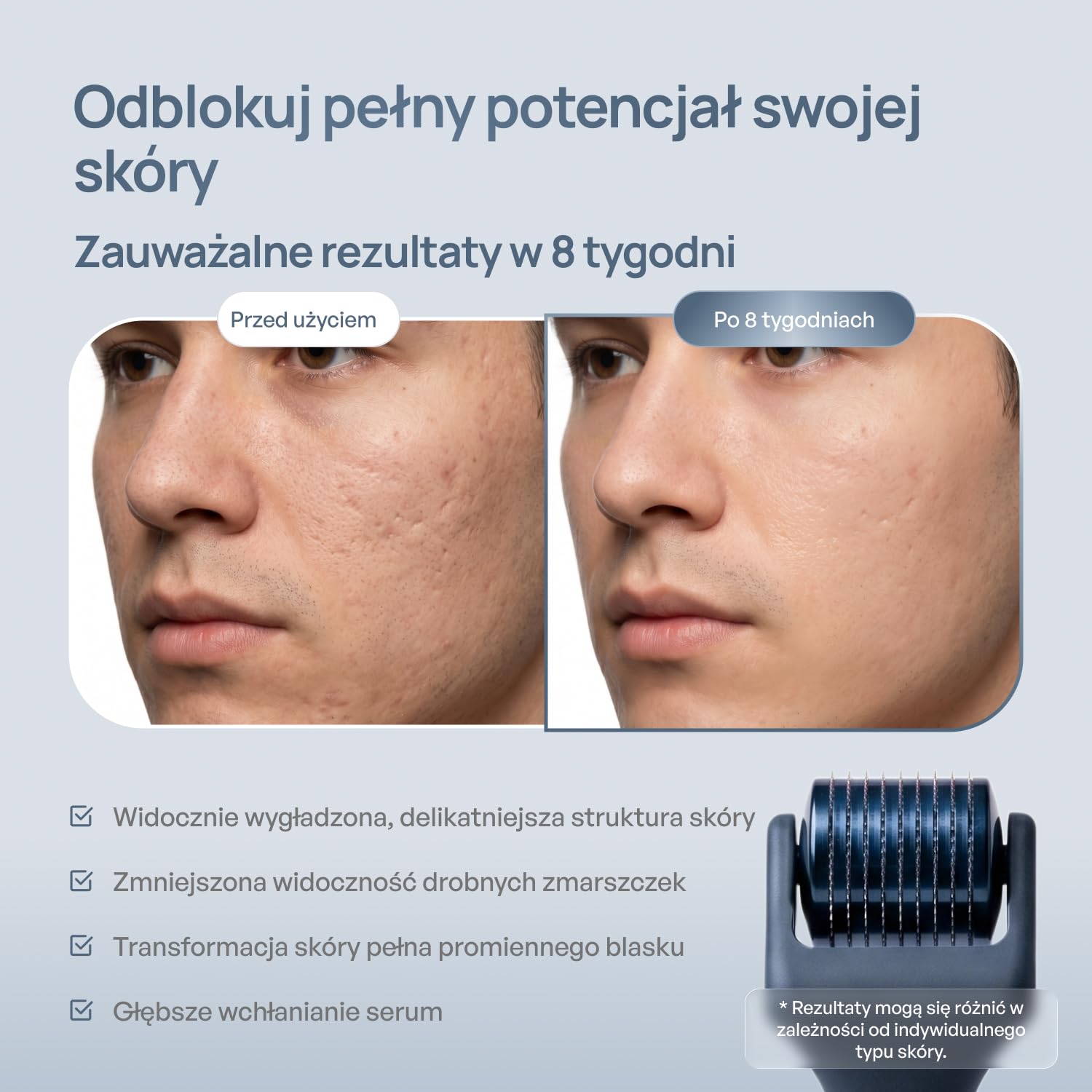 PLANTIFIQUE Dermaroller 0,25 mm – Roller Microneedling do Twarzy, Brody i Skóry Głowy – Tytanowy Wałek z 540 Igłami, Derma Roller – z Etui
