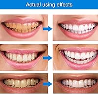 Vista 3 de 3 bolígrafos blanqueadores de dientes, esencia blanqueadora de dientes, gel blanqueador de dientes, removedor de manchas de dientes para blanquear