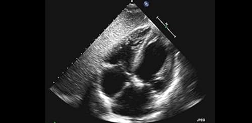 Echocardiography cases