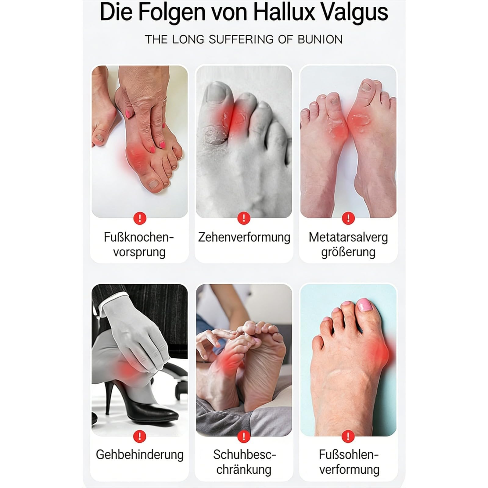 Generisch Hallux Valgus Korrektur Haltungshelfer ValgusVita Nächtliche Zehenkorrektur für schmerzfreie Füße, Bequeme Polsterung & Verstellbarer Riemen für Damen & Herren (Hautfarbe-ein Paar, L)