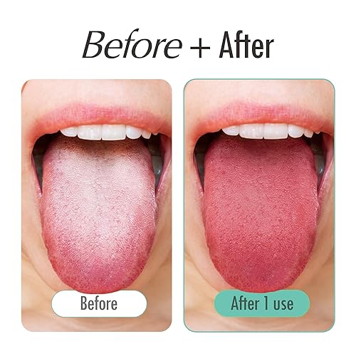Miniatura 3 de Raspador de lengua fresco para adultos  Raspador de lengua 100% acero inoxidable para cuidado bucal  Limpiador de lengua  Limpiador de lengua