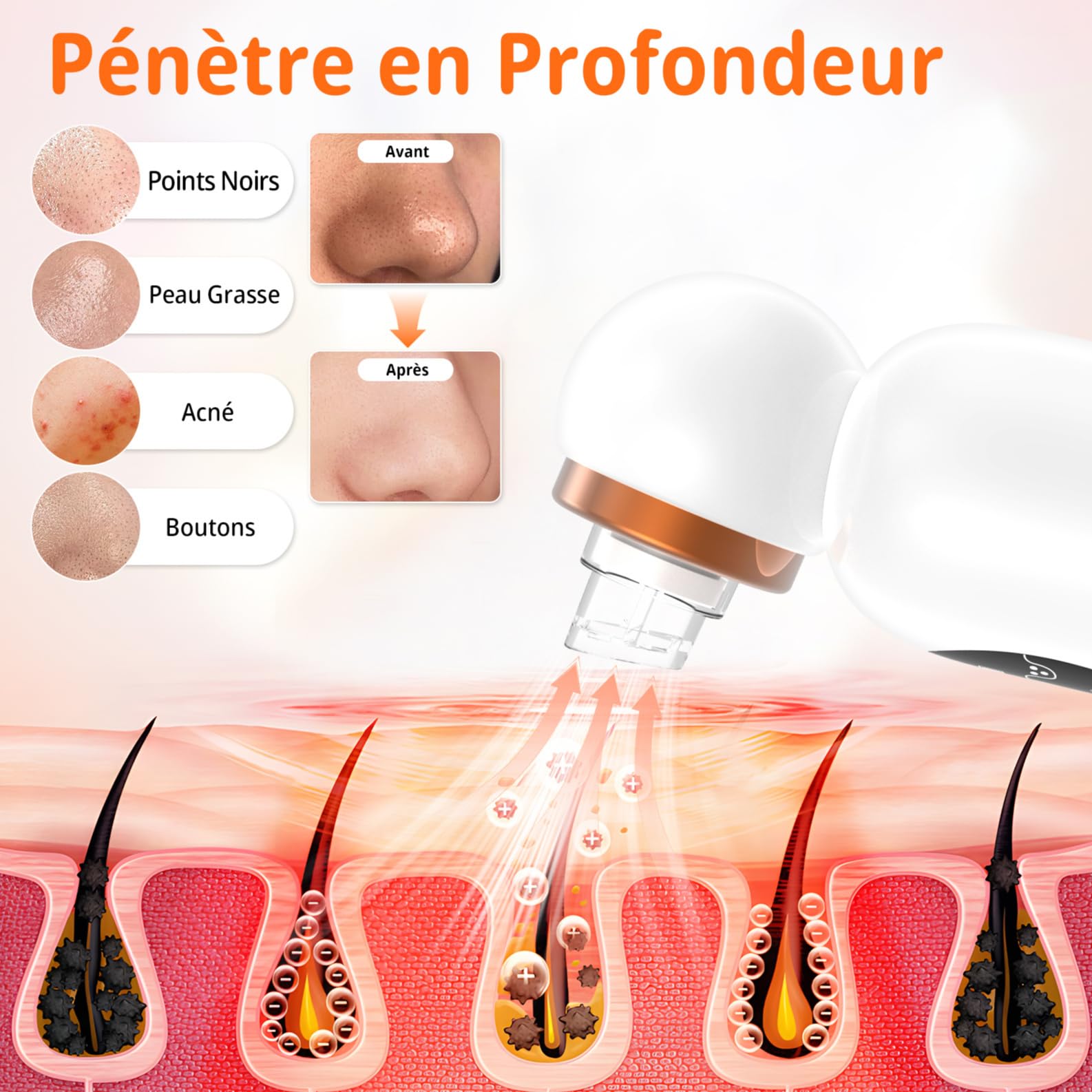 Aspirateur Pour Points Noirs, Extracteur Points Noirs Visage, 3 Modi Rechargeable & 6 Sondes & Réservoir d'eau Visible pour le Nettoyage du Visage, Traitement de l'acné et Soins de la Peau - Blanc
