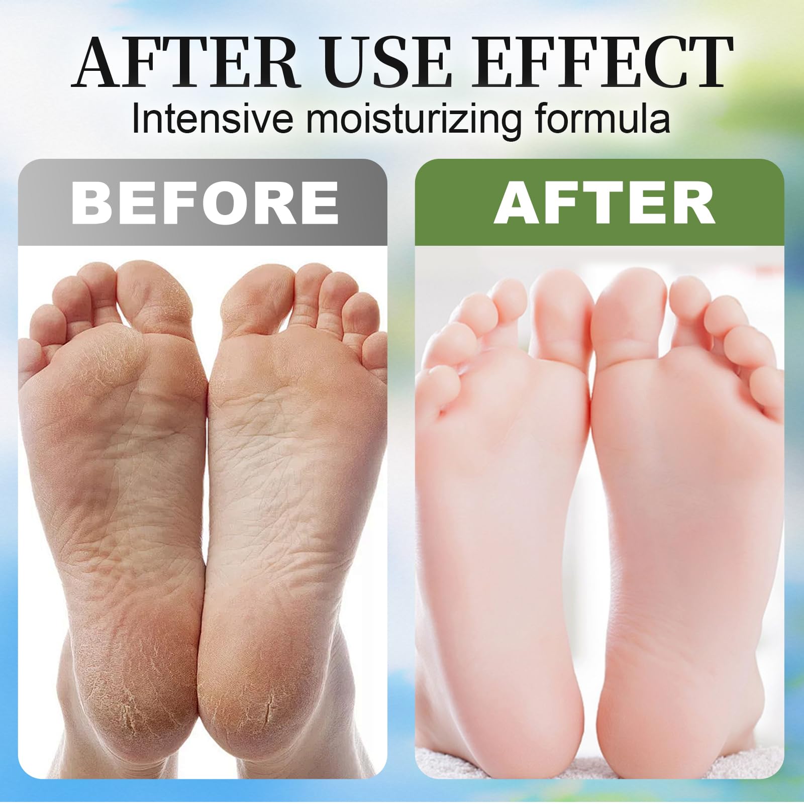 3 Pares Mascarilla Pies Exfoliante y Hidratante, Calcetines Exfoliantes de Pies para Eliminar Durezas y Callos, Peeling Pies Profesional para Pies Suaves, Coco, Lavanda, Aloe Vera - 2